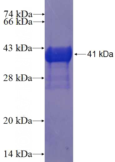 Recombinant Human ZNF385A SDS-PAGE