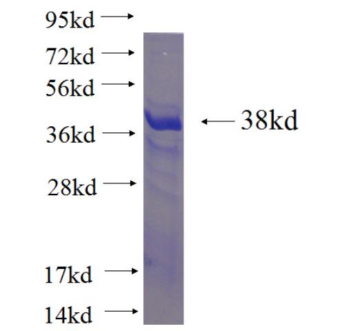 Recombinant human FAM54A SDS-PAGE