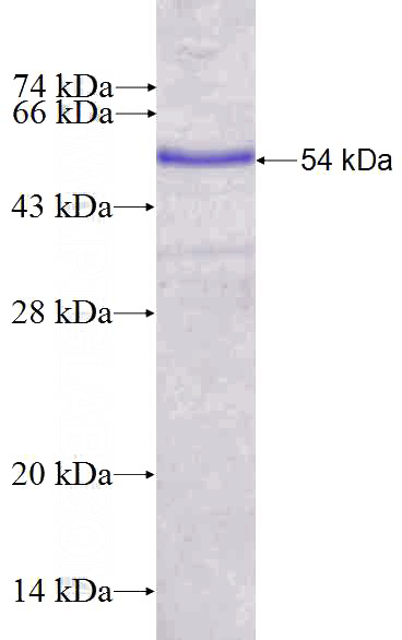 Recombinant Human CCDC147 SDS-PAGE