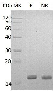Human LGALS14/PPL13 (His tag) recombinant protein