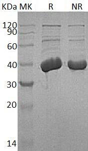 Human MECR/NBRF1/CGI-63 (His tag) recombinant protein