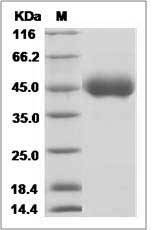 Influenza A H10N8 (A/duck/Guangdong/E1/2012) Hemagglutinin Protein (HA1 Subunit) (His Tag)