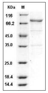 Human c-Yes / YES1 Protein (His & GST Tag) SDS-PAGE
