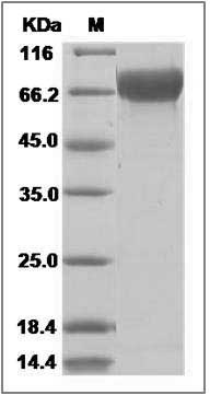 Influenza A H3N2 (A/California/7/2004) Hemagglutinin / HA Protein (His Tag) SDS-PAGE