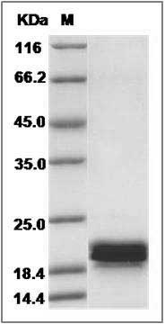 Human CNPY2 Protein (His Tag) SDS-PAGE