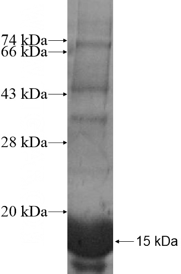 Recombinant Human CLSTN3 SDS-PAGE