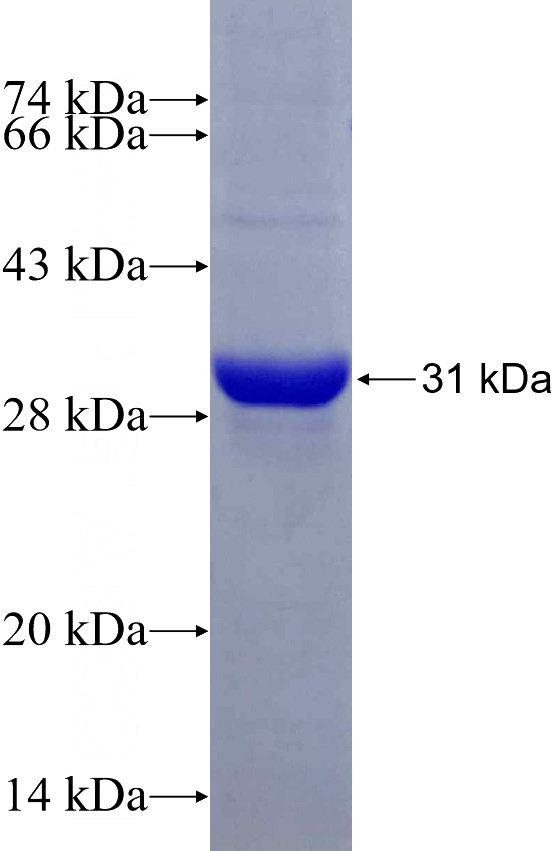 Recombinant Human CPLANE2 SDS-PAGE