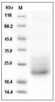 Mouse CD7 Protein (His Tag) SDS-PAGE