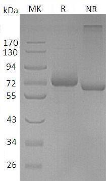 Human LILRB5/LIR8 (His tag) recombinant protein