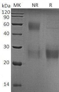 Human KLRD1/CD94 (His tag) recombinant protein