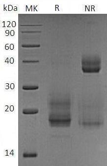 Human CD69/CLEC2C (His tag) recombinant protein