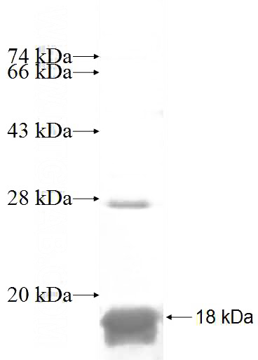 Recombinant Human NRARP SDS-PAGE