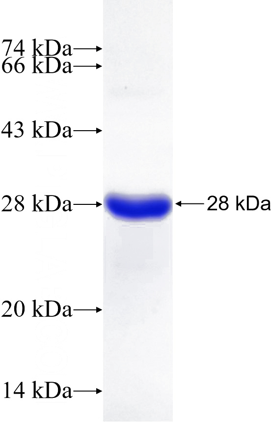 Recombinant Human CSN1S1 SDS-PAGE