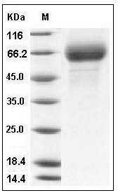 Influenza A H3N2 (A/Brisbane/10/2007) Hemagglutinin Protein (HA1 Subunit) (His Tag) SDS-PAGE