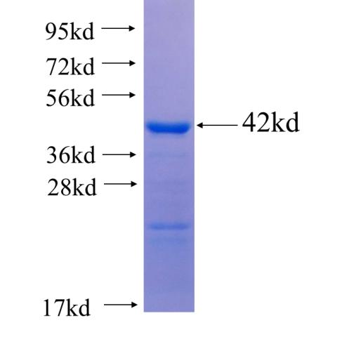 Recombinant human PSTPIP2(Full length) SDS-PAGE