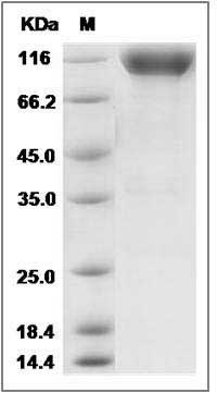 Mouse CSF1R / MCSF Receptor / CD115 Protein (His & Fc Tag) SDS-PAGE