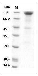 Human TrkB / NTRK2 Protein (His & Fc Tag) SDS-PAGE