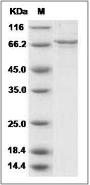 Human Arginosuccinase / ASL Protein (His & GST Tag) SDS-PAGE