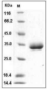 Mouse EPOR Protein (His Tag) SDS-PAGE