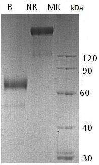 Human KIR2DL3/CD158B2/KIRCL23/NKAT2 (Fc tag) recombinant protein