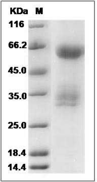 Human KIR2DL4 / CD158D Protein (Fc Tag) SDS-PAGE