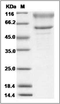 Rat CDH13 / Cadherin-13 / H Cadherin Protein (Fc Tag) SDS-PAGE