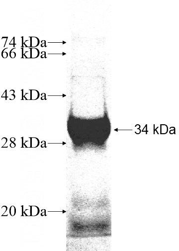 Recombinant Human ACOX3 SDS-PAGE