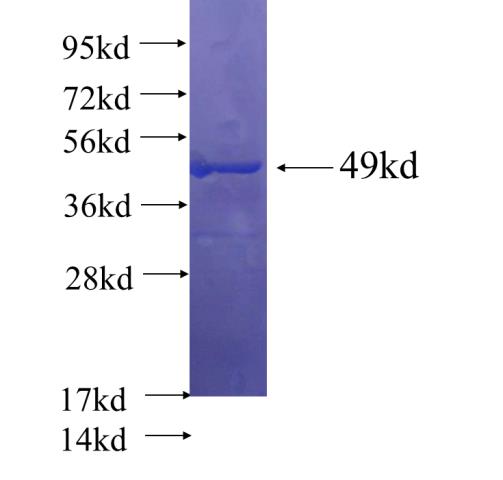 Human IDH3G Recombinant protein (His tag)