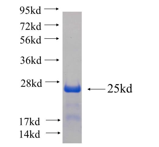 Recombinant human CUL4A SDS-PAGE