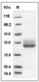 Human CD137 / 4-1BB / TNFRSF9 Protein (His Tag) SDS-PAGE