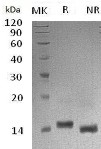 Human LALBA/LYZL7 (His tag) recombinant protein