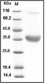Human ACP5 / TRAP Protein (His Tag) SDS-PAGE