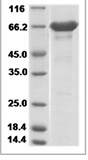 Mouse Carbonic anhydrase inhibitor/ICA Protein 15476
