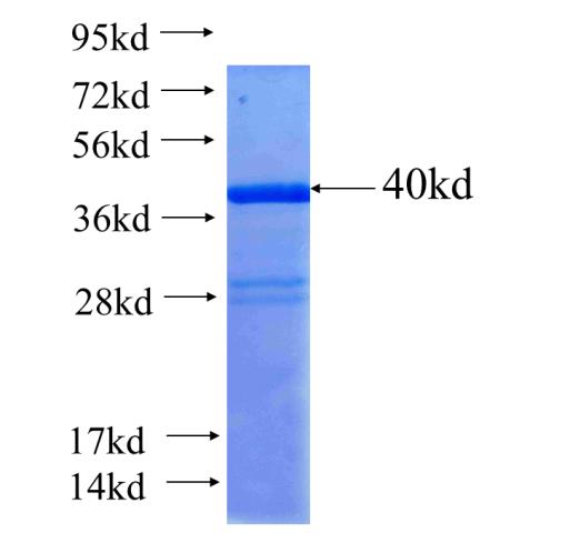 Recombinant human NKX2-3 SDS-PAGE