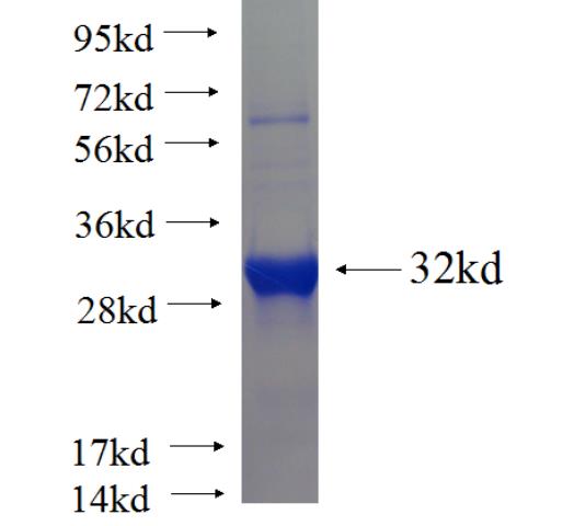 Recombinant human MT2A SDS-PAGE