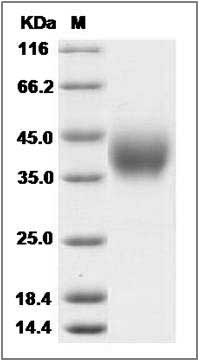 Cynomolgus B7-DC / PD-L2 / CD273 Protein (His Tag) SDS-PAGE