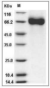 Human CHST15 / GALNAC4S-6ST / BRAG Protein (His Tag) SDS-PAGE