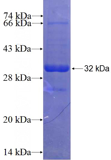 Recombinant Human FAM126A SDS-PAGE