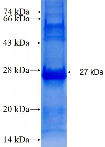 Recombinant Human DHRS7 SDS-PAGE