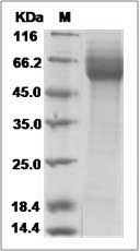 Rat ECM1 Protein (His Tag)