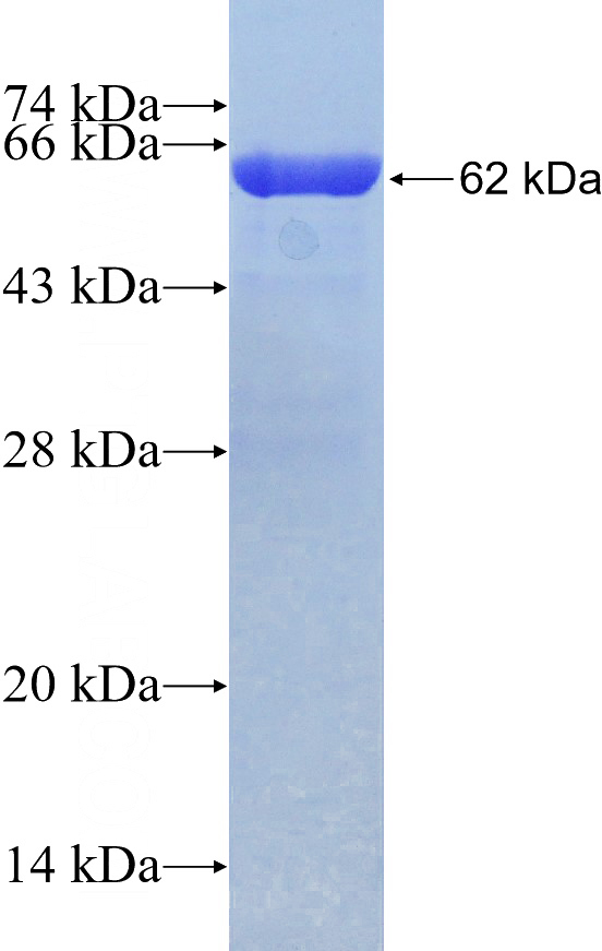 Recombinant Human TRIM72 SDS-PAGE
