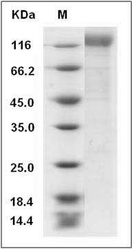 Human Immunodeficiency Virus type 1 (HIV-1) gp140 Protein (His Tag) SDS-PAGE