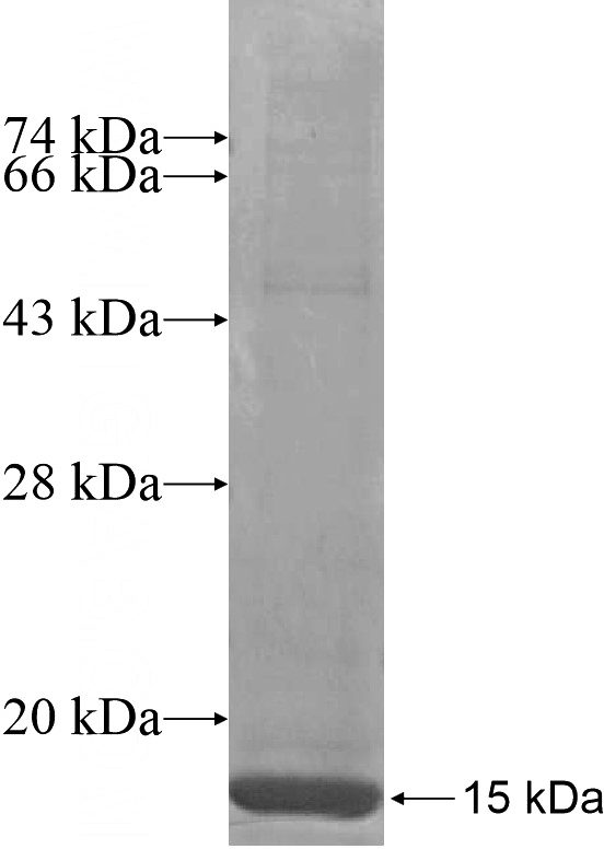 Recombinant Human ZDHHC19 SDS-PAGE