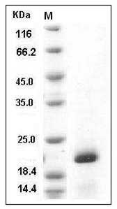 Human PIN1 / Rotamase Pin1 Protein (His Tag) SDS-PAGE