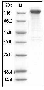 Human SLITRK1 Protein (His & Fc Tag) SDS-PAGE