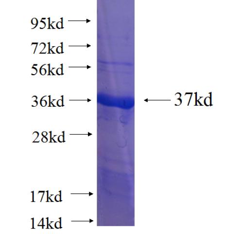 Recombinant human C5orf33 SDS-PAGE