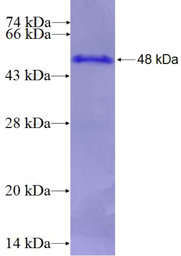 Recombinant Human CPXM1 SDS-PAGE