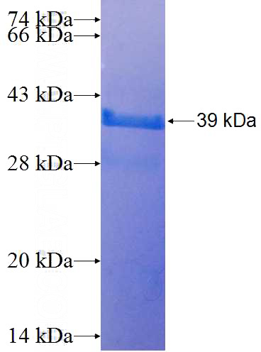 Recombinant Human TRIM26 SDS-PAGE