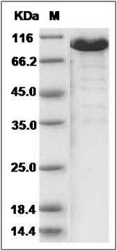Cynomolgus EphB6 / EphB6 Protein (Fc Tag) SDS-PAGE