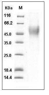 Human CD16b / FCGR3B Protein (His Tag) SDS-PAGE